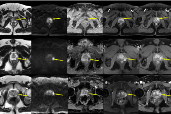 2025 01 14 Radiology Huang Figure5 Thumbnail