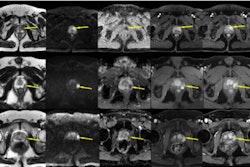 2025 01 14 Radiology Huang Figure5 Thumbnail