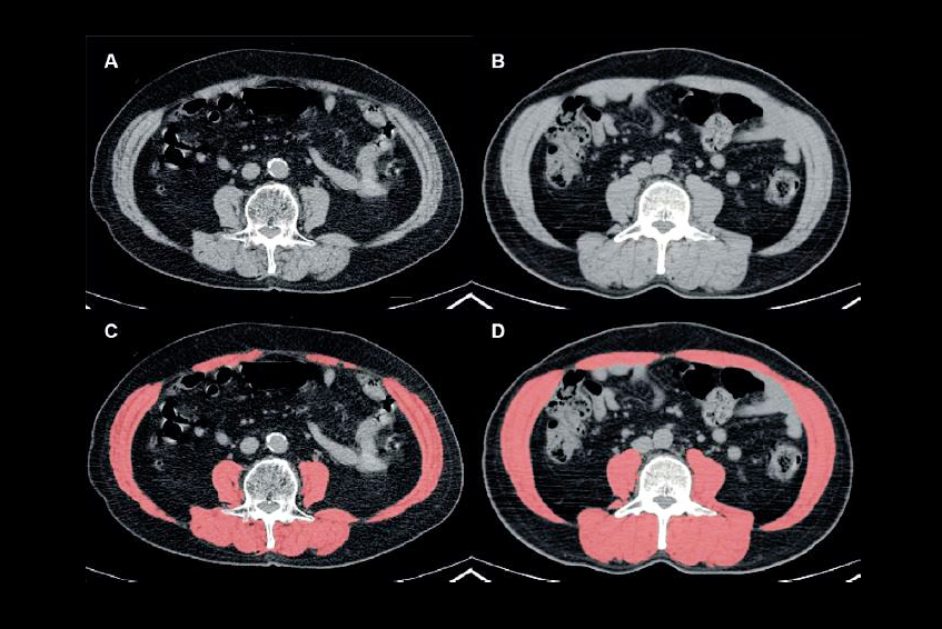 2025 01 28 Radiology Lee Figure2 Thumbnail