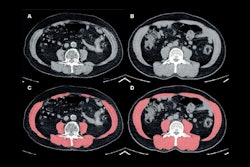 2025 01 28 Radiology Lee Figure2 Thumbnail