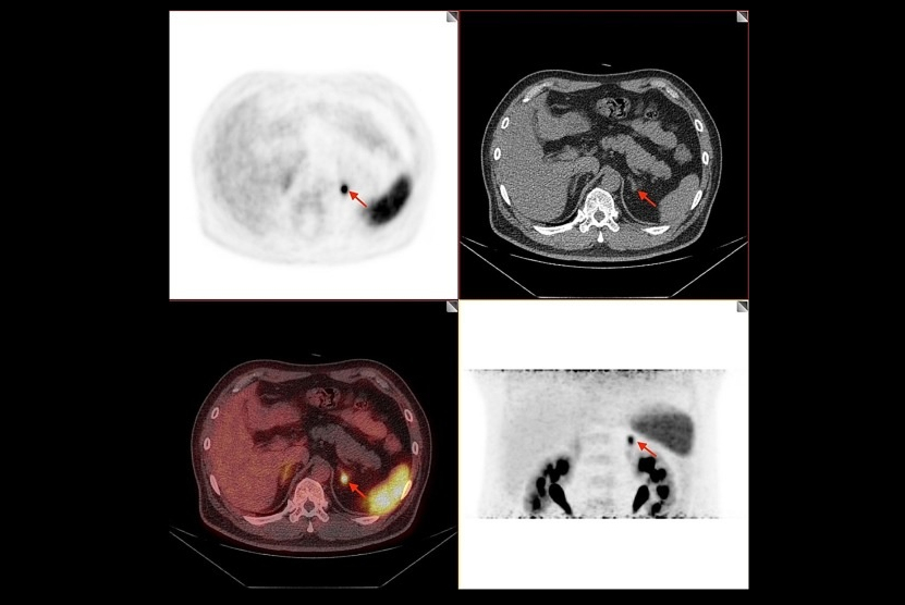 Apa 679bd41fd4afc Thumbnail