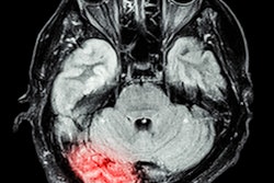 Mri Brain Disease1 400