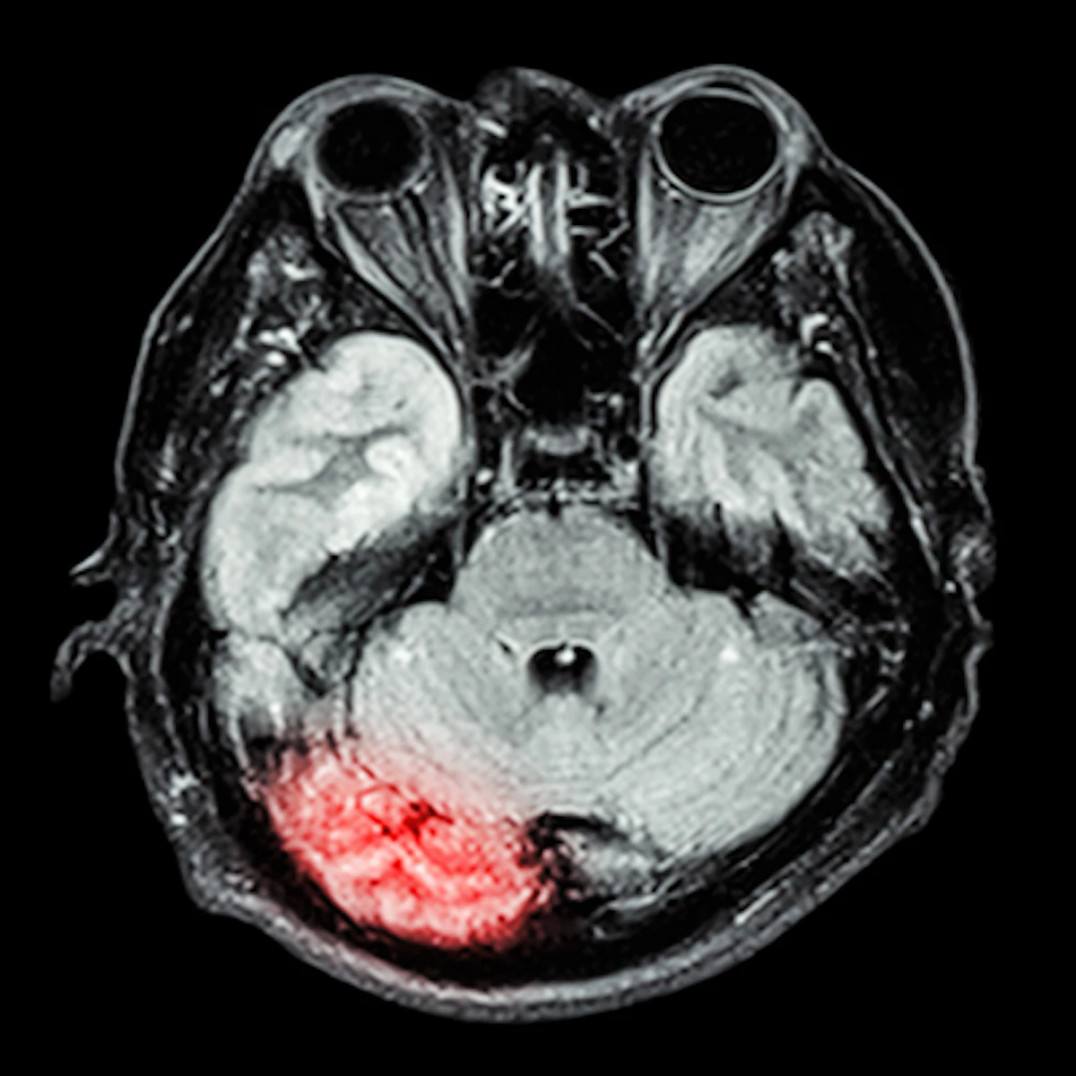 FDA Clears MRI Software for Neurodegenerative and Vulvar Diagnosis