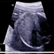 Smfm Ultrasound Ai Fetal Thumbnail
