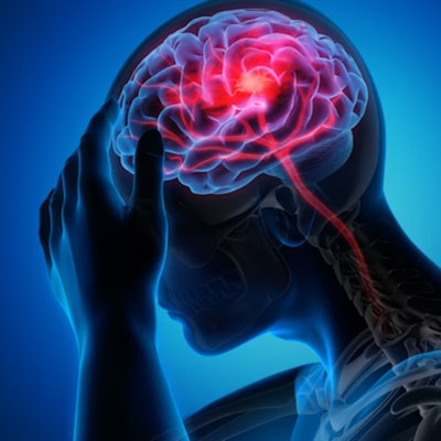 Stroke Evt