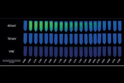 2025 02 06 Thumbnail Image Of Gadoxetate Disodium Dilution Series From Custom Phantom Thumbnail