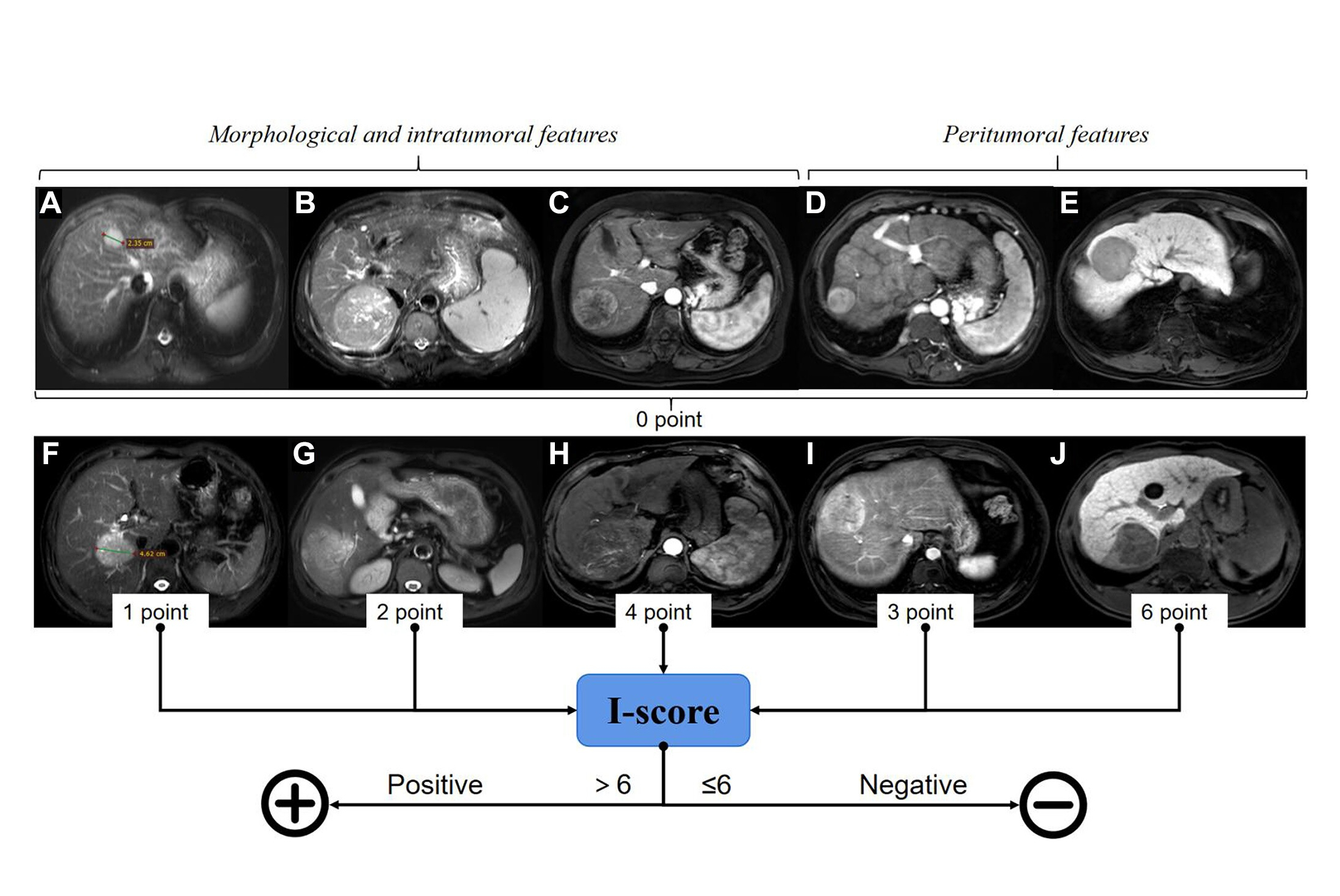 2025 02 11 I Score Thumbnail