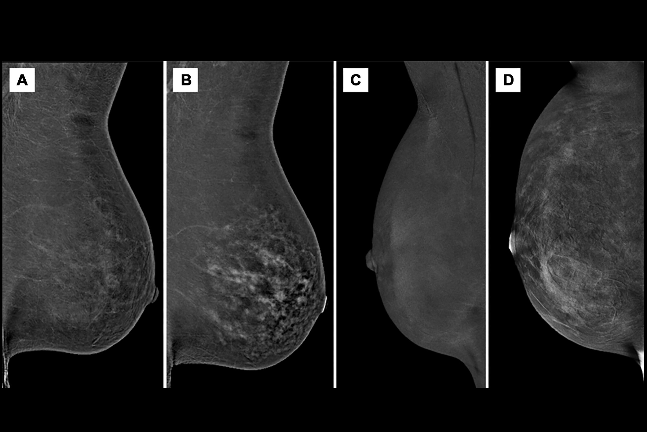 2025 02 12 Images Large Radiol Thumbnail