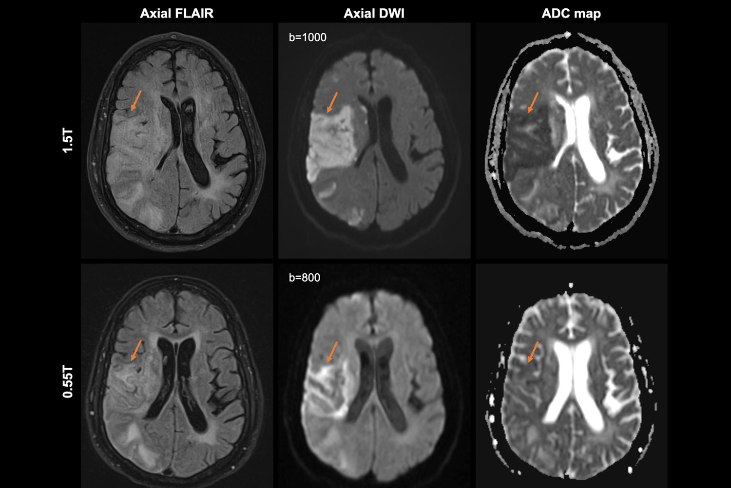 2025 02 13 Radio Graphics Kelsey Figure1 Thumbnail