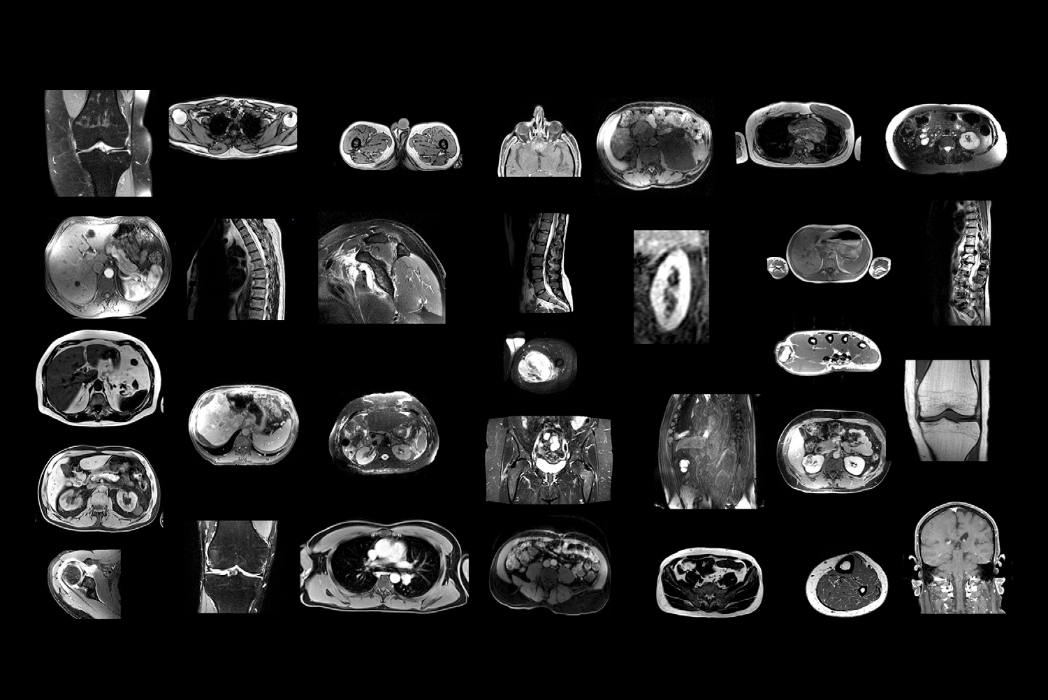 2025 02 18 Radiology D Antonoli Figure1 Thumbnail