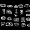 2025 02 18 Radiology D Antonoli Figure1 Thumbnail