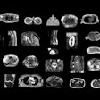 2025 02 18 Radiology D Antonoli Figure1 Thumbnail