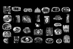2025 02 18 Radiology D Antonoli Figure1 Thumbnail