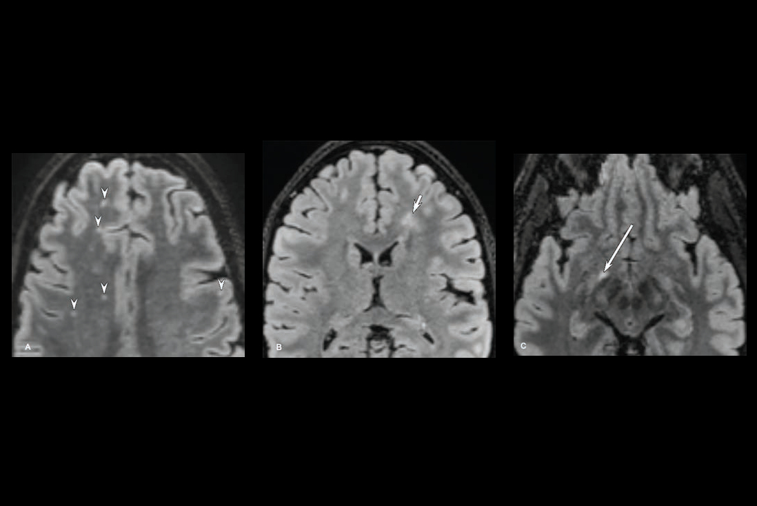 2025 02 19 Ajr Tanwar Figure2 Thumbnail