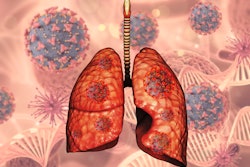 3 D Lungs Covid Virus Cells