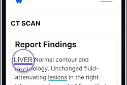 PocketHealth Image Reader.