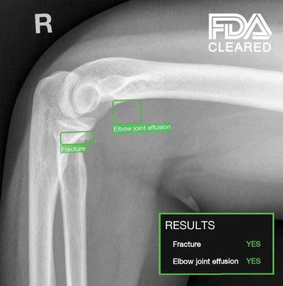 TechCare Trauma. Image courtesy of Milvue.