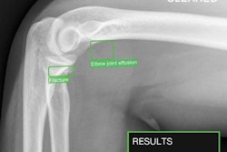 TechCare Trauma. Image courtesy of Milvue.