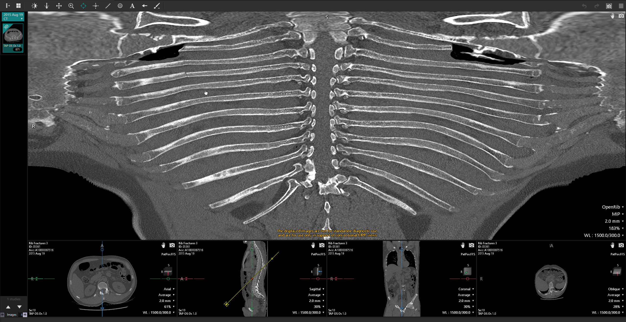 Open Rib Interactive Layout