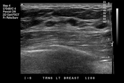 Breast Ultrasound