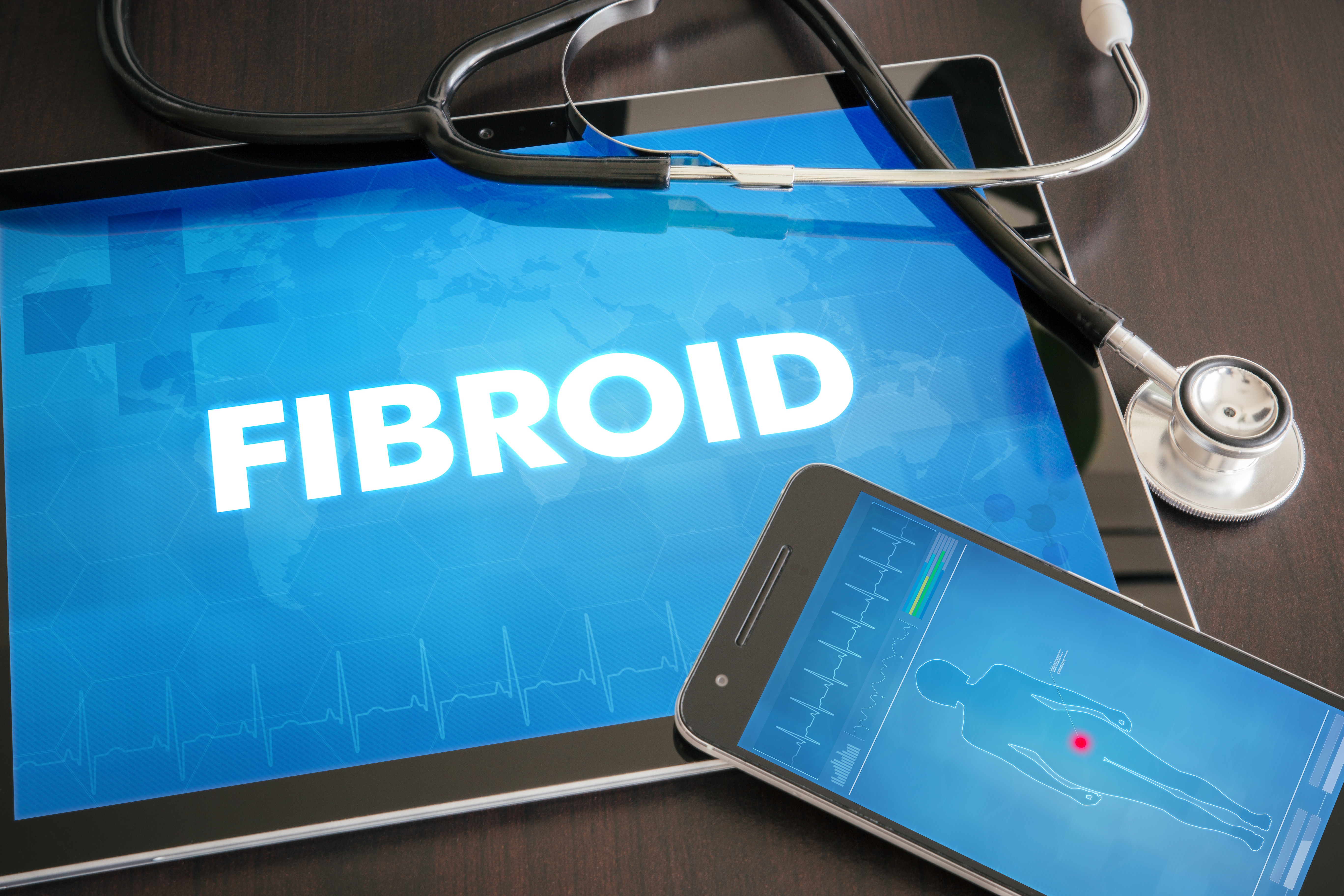 Fibroid