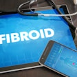 Fibroid