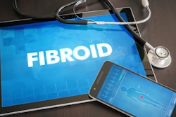 Fibroid