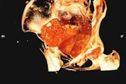 Pregnantmummy