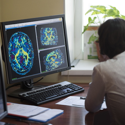 Radiologist Ct Scan Brain Tumor 400