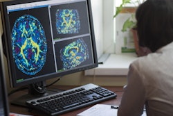 Radiologist Ct Scan Brain Tumor 400