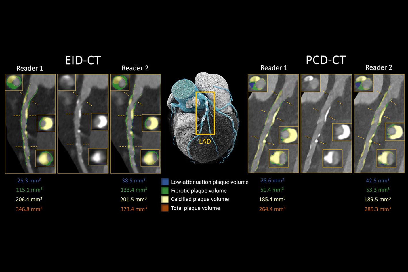 2025 03 04 Radiology Vecsey Figure5 Thumbnail