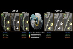 2025 03 04 Radiology Vecsey Figure5 Thumbnail