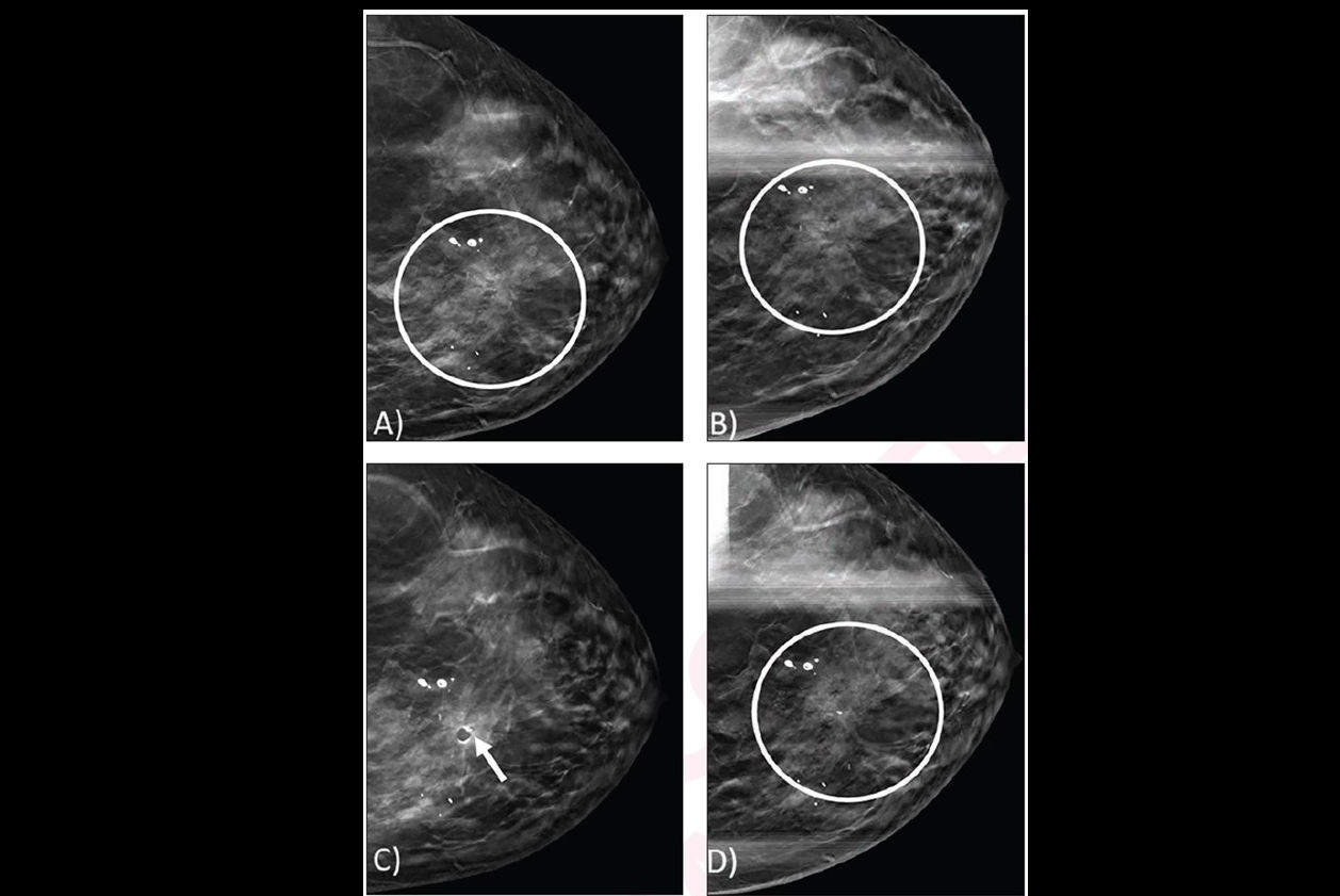 2025 03 12 Ajr Dbt Distortions Thumbnail