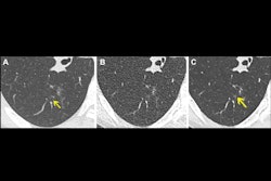 2025 03 13 Radiology Klug Figure4 Thumbnail