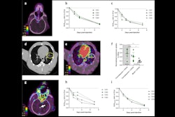 2025 03 24 Covid Brain Thumbnail