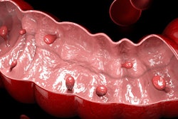 Colon