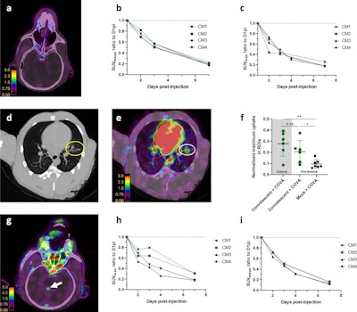 Representative PET/CT fusion axial view of the sinus of one convalescent animal (CM2) with the corresponding quantification (b, c) of the mean and maximum Zr-89 COVA1-27-DFO PET signal in the brain of all animals normalized to that at day 1 post-injection. (d) Representative CT lung lesion, indicated by the yellow circle, and its associated PET signal (e), indicated by the white circle, on day 7 post injection. (f) Corresponding quantification of the maximum PET signal in the lesional (gray background, n = 6 areas) and nonlesional areas (square symbols, white background, n = 6 areas) on day 7 post injection compared with that for naïve animals (black symbols (n = 7 areas). (g) Axial view of the Zr-89 COVA1-27-DFO PET signal in the brain, indicated by the white arrows, at day 3 post injection. Corresponding quantification (h, i) of the maximum and mean Zr-89 COVA1-27-DFO PET signal in the brains of all animals normalized against that on day 1 post injection. Mann Whitney two-sided t-test, *: p = 0.014, **: p = 0.008. Convalescent + COVA animals are indicated in green and the mock + COVA animals in black. Data are presented as individual values and the associated mean and SD. Source data are provided as a Source data file. Image and caption available for republishing under Creative Commons license (CC BY 4.0 DEED, Attribution 4.0 International) and courtesy of Nature Communications.