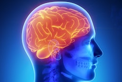Brain General Thumbnail
