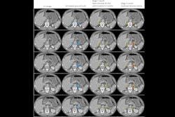 Images Large Radiol Thumbnail