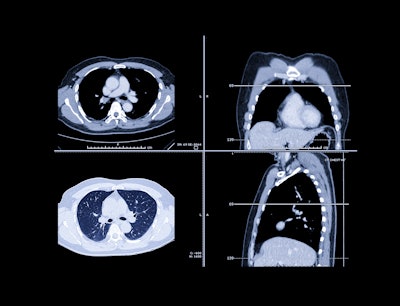 Lung Ct Images