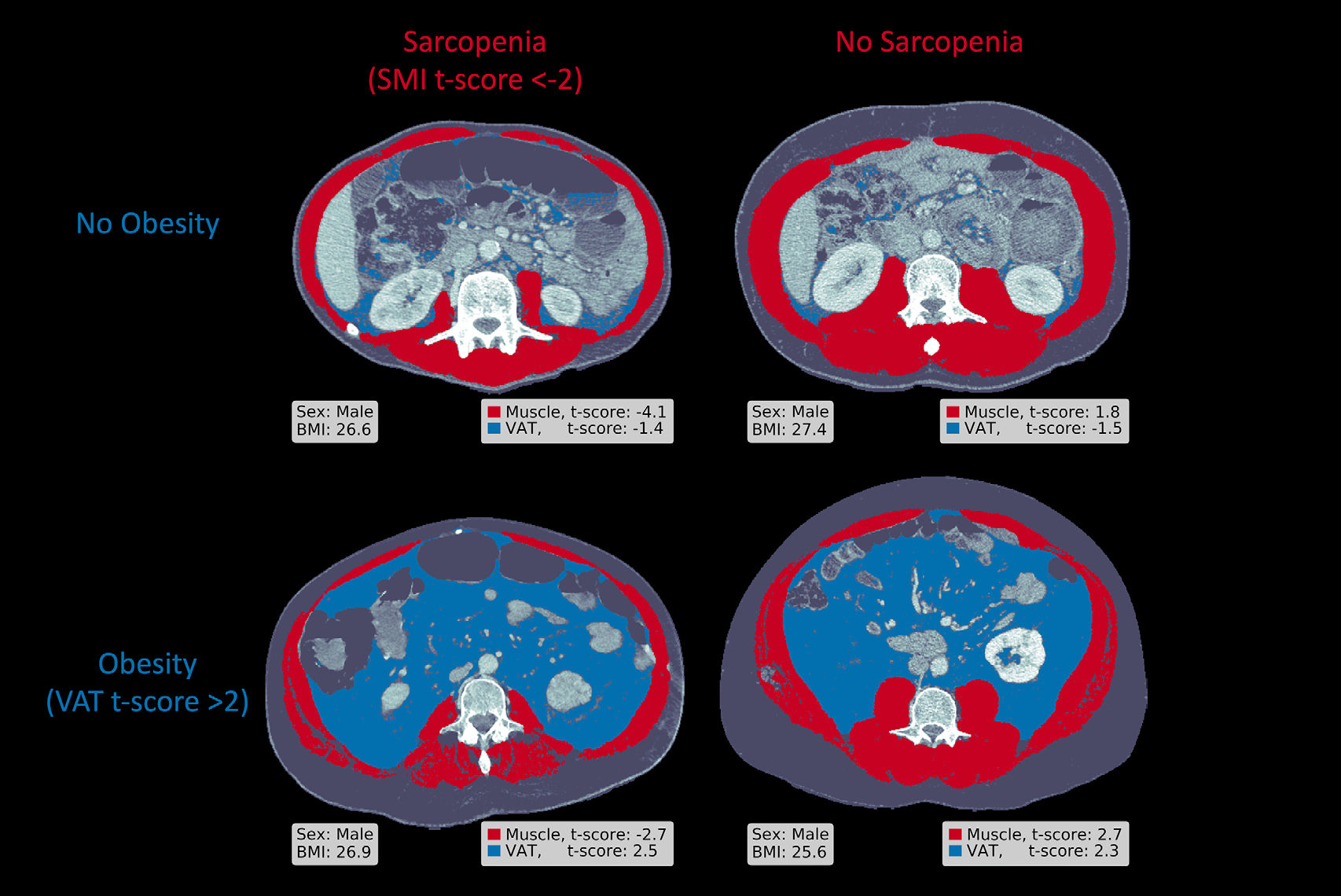 2025 04 15 Radiology Chaves Figure1 Thumbnail