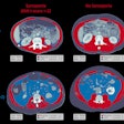 2025 04 15 Radiology Chaves Figure1 Thumbnail