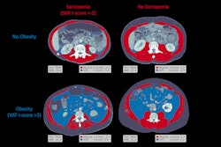2025 04 15 Radiology Chaves Figure1 Thumbnail