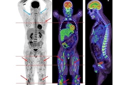 Covid 19 Vax Thumbnail