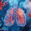 Lung Cancer