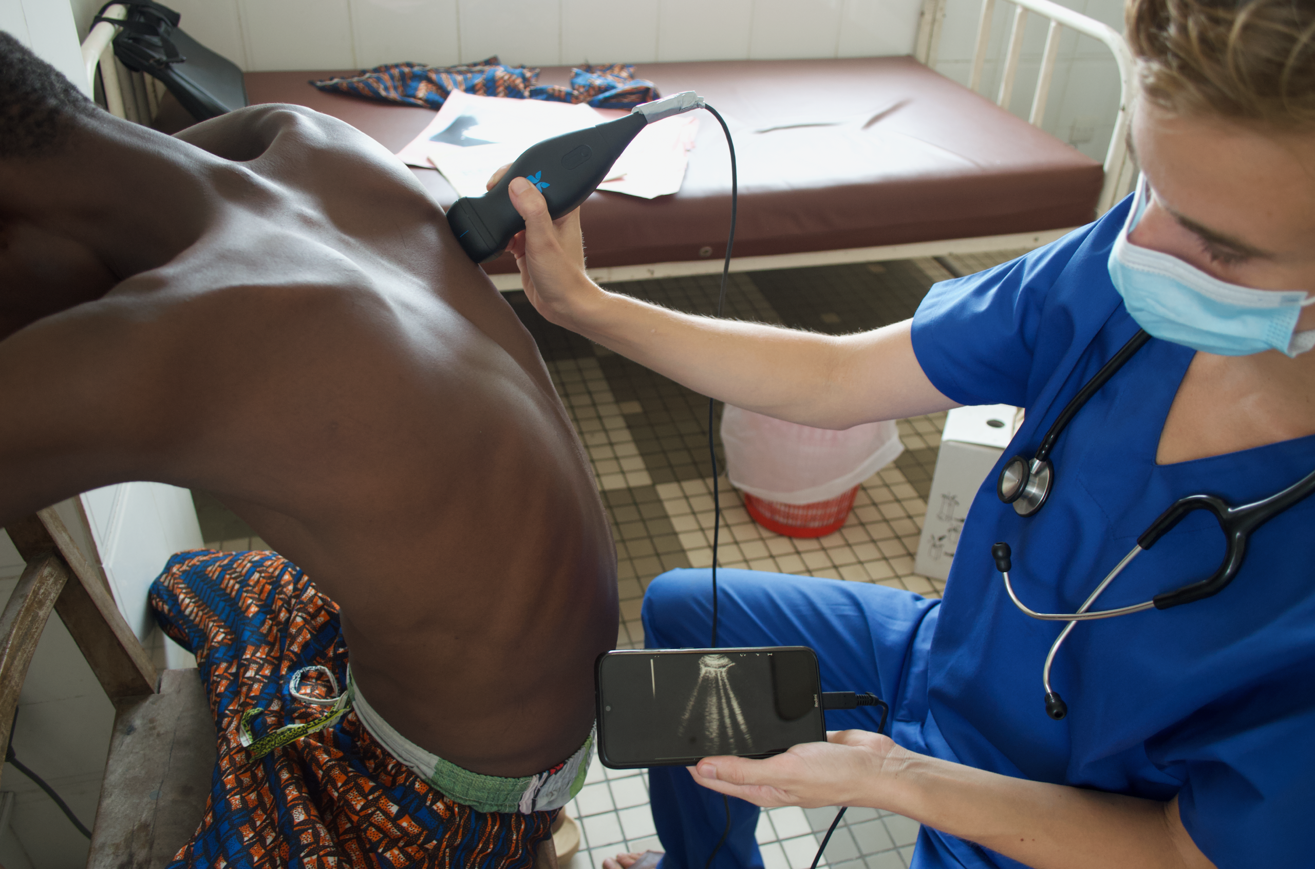 V&eacute;ronique Suttels, PhD, performs an ultrasound scan on a patient in Benin, West Africa, using a POCUS scanner connected to a smartphone. Her team studied how an AI-guided POCUS system can help diagnose tuberculosis in patients with respiratory symptoms. Image courtesy of V&eacute;ronique Suttels, PhD.