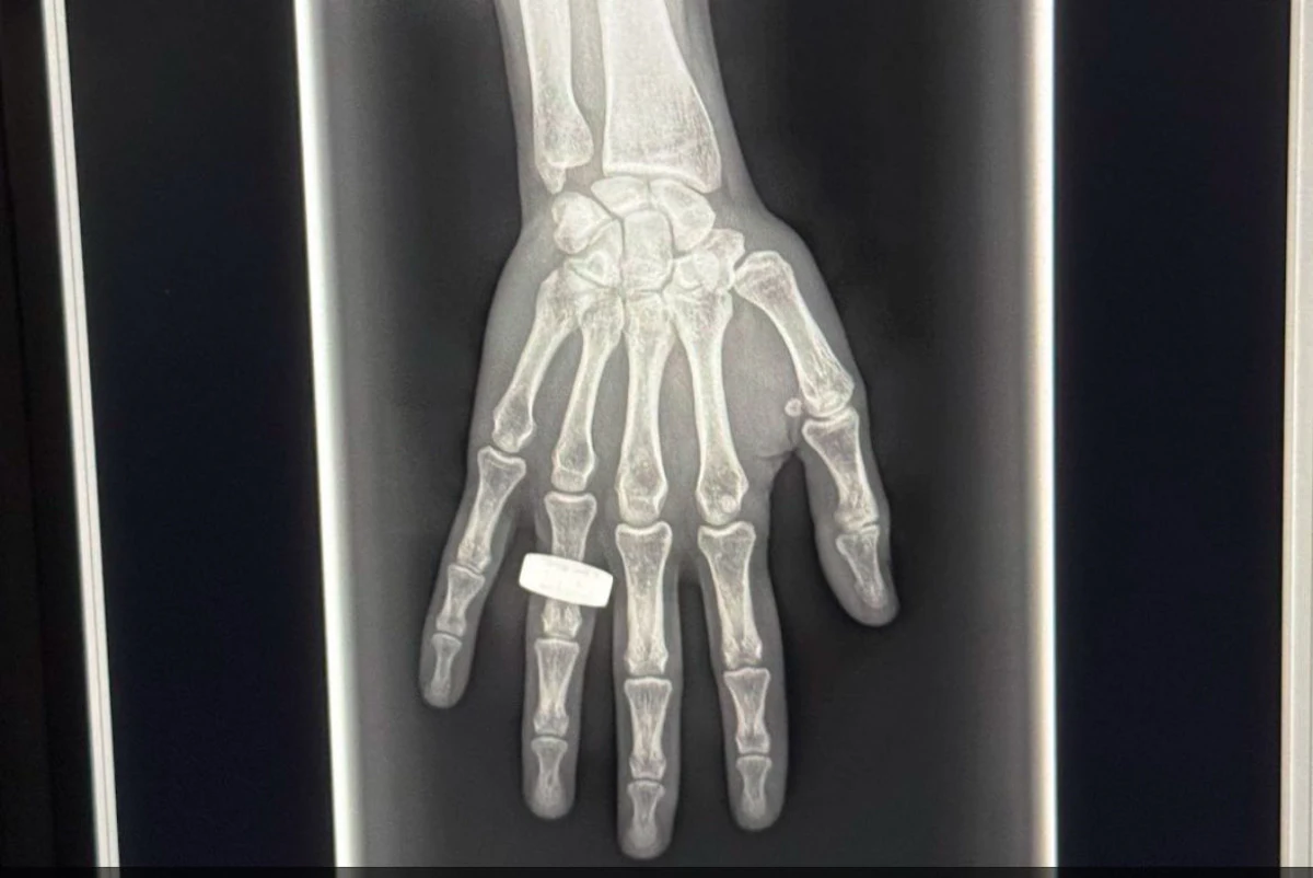 Fram2 Mission Conducts First Human X-Ray in Space