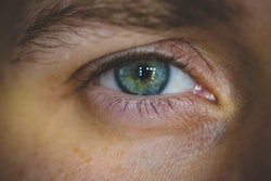 Eye Pexels