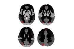 Images Medium Radiol Thumbnail