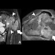 2025 04 22 Radiology Lemore Figure2 Thumbnail